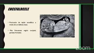 🔴 CURSO NEUROIMAGEN FETAL Y PERINATAL [upl. by Rosalie993]