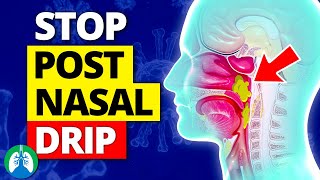 Top 10 Ways to Stop a Cough from Postnasal Drip [upl. by Lisk]