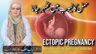 What is Ectopic pregnancy  Risk factorssymptoms and Treatment of Ectopic Pregnancy by Dr Zainab [upl. by Salvay7]