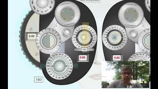 Retinoscopy with Refracting Instrument Minus cylinder [upl. by Acinorahs372]