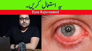 Dr ZeeBest Natural Pink Eye Conjunctivitis Remedy  आँख आना [upl. by Sethrida]