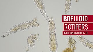 Bdelloid rotifers  An entire class of animals with no males  by Motic Europe [upl. by Ardnot]