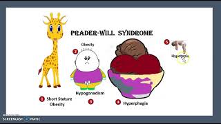 PraderWilli VS Angelman Syndrome Imprinting Causes Symptoms USMLE NCLEX MCAT 3 Minutes [upl. by Revorg]