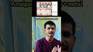 Dental filling amalgam dental cavity material viral shorts by vivek sir [upl. by Andros]