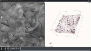 Slice of xenograft of human breast cancer in mouse Cell line MDAmb2312 [upl. by Bettina163]