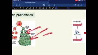 Cancer chemotherapy 1  hematology  Dr Saiko [upl. by Eednar]