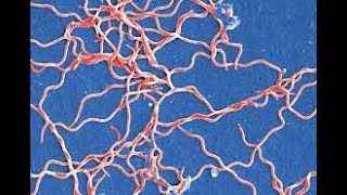 Bacteriologia  Borrelia y Leptospiras  010724 [upl. by Eiznekcam496]