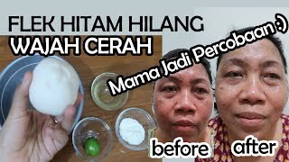 Masker alami untuk menghilangkan flek hitam dengan Bengkoang Review Velrose Secret [upl. by Merrel938]