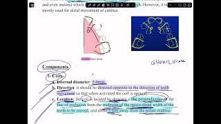 شرح lab45finger springp2gurded spring طب اسنان مرحلة رابعه [upl. by Ingold456]