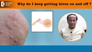 Why do I keep getting HIVES on and off  Types of Urticaria amp TriggerDrD A SatishDoctors’ Circle [upl. by Anasxor]