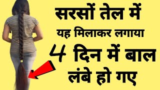 सरसों तेल में यह मिलाकर लगाया 4 दिनों में बाल इतने लंबे मोटे और घने हो गएBaal Badhane Ke Upay [upl. by Mahon]