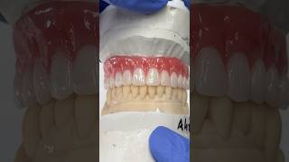 From Impression to Locator TryIn ​⁠EnvisiontecMain envisiontec lsk121shorts dentistry teeth [upl. by Akimot412]