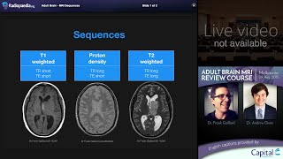 MRI Brain Sequences  radiology video tutorial [upl. by Ayinat]