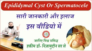 Everything you need to know about Spermatocele or Epididymal Cyst And Unani Nuskha by Dr Nizamuddin [upl. by Deach797]