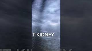 Bilateral Renal Parenchyma Disease Grade 2 ultrasound video viral shorts like subscribe [upl. by Eleahcim]