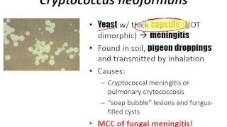 USMLE Review  Micro Fungi [upl. by Sukram]