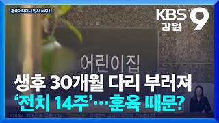 생후 30개월 다리 부러져 ‘전치 14주’…어린이집 “다툼 제지하려”  KBS 20241111 [upl. by Tabber678]