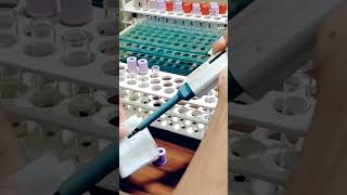 Haemoglobin  HB Test In Bengali Short StatusMedical Lab Technician Rajib [upl. by Nodnek]