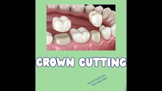 quotMastering Crown Cutting in Dentistry – StepbyStep Guide with Pro Tips 🦷👑quot [upl. by Critta322]