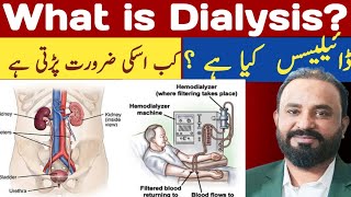 Dialysis  CKD  chronic kidney disease  what is dialysis  Hemodialysis Kidney Treatmentviral [upl. by Deach333]