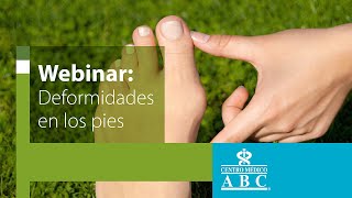 Webinar deformidades en los pies juanetes y dedos en garra [upl. by Lohcin]