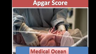 APGAR Newborn Assessment test scale in Urdu Hindi [upl. by Evonne]