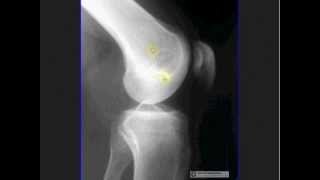 How to Interpret Musculoskeletal Radiographs [upl. by Eimaral]