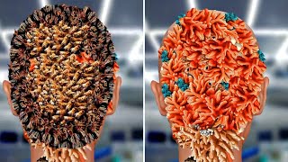 ASMR Removed Flying 😔 Bees Making Honey Comb on Head infection treatment Asmr animation bkasmr20 [upl. by Sirromed727]