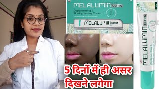 Melalumin Ultra Depigmenting Cream Uses amp Side effects in hindi  Melalumin Ultra skin cream uses [upl. by Nanek401]