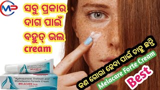 Melacare Forte Cream For Melasma Benefits And Sideeffects Review In Odia [upl. by Yekcir]