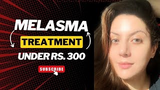 Melasma Removal at Home I Melasma Remove cream under Rs 300 I Melasma Skin Care Regimen Routine [upl. by Okuy87]