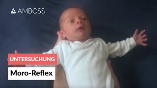 MoroReflex  Frühkindliche Reflexe  AMBOSS Video [upl. by Neelon]