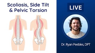 Scoliosis Side Tilt amp Pelvic Torsion  CBT Coaching 12424 [upl. by Mohl813]