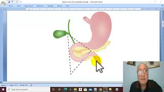 Pancreatic Disorders in Arabic 6  Zollinger Ellison Syndrome  by Dr Wahdan [upl. by Bilski]