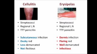 cellulitis vs erysipelas [upl. by Oigile536]