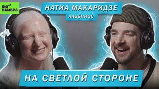 АЛЬБИНОС НАТИА МАКАРИДЗЕ  НА СВЕТЛОЙ СТОРОНЕ [upl. by Giacamo]