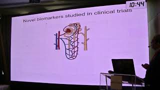 Biomarkers for diabetic kidney disease prof Ayman Refaie [upl. by Serg]