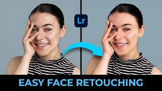 Complete Face Retouch amp Pimple Removal in Lightroom  Easy Steps for Smooth Skin Malayalam [upl. by Marilin231]