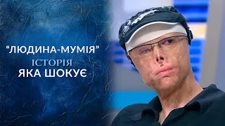 ЧЕЛОВЕКМУМИЯ Уникальный случай который ШОКИРУЕТ весь мир quotГоворить Українаquot Архів [upl. by Nickolai]