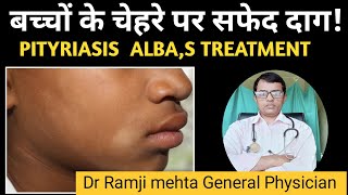 White Patch on Face  Is This Vitiligo or Pityriasis Alba बच्चों के चेहरे पर सफेद दागDr Ramji [upl. by Jarrad]