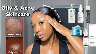 SKINCARE ROUTINE FOR OILY ACNEPRONE SKIN  A routine for smooth amp clear Skin ‼️ [upl. by Adnir152]