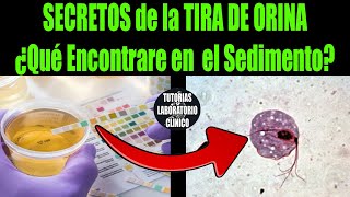 🔥 Descubre el SECRETO DEFINITIVO ¿Que Encontraré en el SEDIMENTO URINARIO según la TIRA DE ORINA🔬 [upl. by Eniretak326]