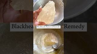 1 Day BlackheadsWhiteheads Removal Glass Shine Nose blackheads skincare beauty [upl. by Ahsilahk]