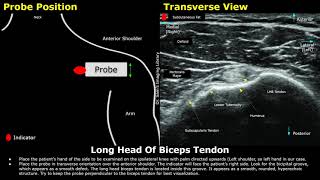 How To Scan The Biceps Tendon On Ultrasound  Shoulder USG Probe Positioning amp Image Orientation [upl. by Anivad]