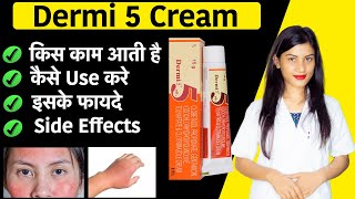 Dermi 5 Cream Uses for Face  Dermi 5 Cream Uses in Hindi  Clobetasol Propionate Gentamicin Cream [upl. by Nabetse718]