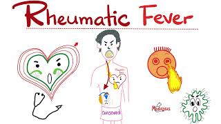 Rheumatic Fever  Jones Criteria  Causes Signs Symptoms Diagnosis amp Treatment  Cardiology [upl. by Fondea]