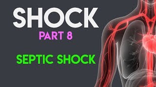 Septic Shock  Shock Part 8 [upl. by Reames54]