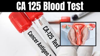 CA 125 Blood Test Explained Uses Procedures and What It Means for You [upl. by Alomeda]