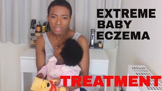 EXTREME BABY ECZEMA TREATMENT [upl. by Narhet318]