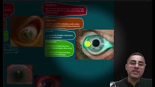 Eye Pain Causes Symptoms and Treatment [upl. by Bernardo]